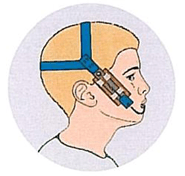 Üst Çene Dentoalveolar Pozisyon 2