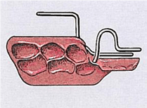 Üst Çene Dentoalveolar Pozisyon 4