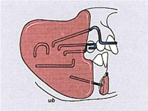 Üst Çene Dentoalveolar Pozisyon 5
