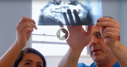 SINUS AUGMENTATION SURGERY
